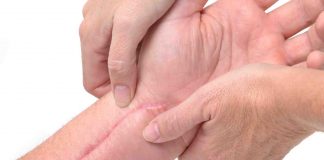 Natural Remedies For Different Types Of Scars